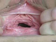 斯特拉得到迪克和暨